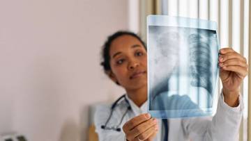 Cara Membersihkan Paru-paru Secara Alami 