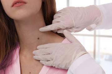 Hindari Kebiasaan Ini Agar Tak Sebabkan Masalah Tiroid