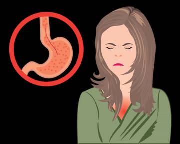 GERD, Beresiko Akibatkan Kematian