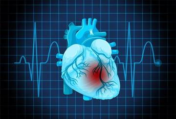 Henti Jantung Mendadak: Kondisi Gawat yang Mengancam Nyawa