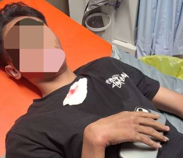 Pulang Nongkrong, Remaja di Pandak Dianiaya Orang Tak Dikenal