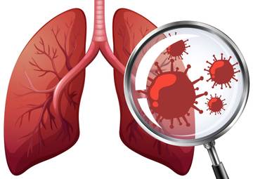 Kesalahan Diagnosis TB, Berdampak Cukup Serius
